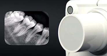 vatech: Визиографы Handy HDR-500, EzSensor Classic (Vatech), Dental Sensor R1 — 1