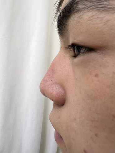 Косметика: Процедура перманентного макияжа губ позволяет придать губам желаемый — 48