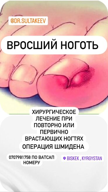 врач хирург: Вросший ноготь (онихокриптоз) — это врастание ногтевой пластинки в