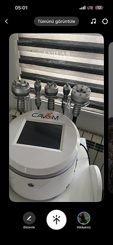 arıqlama: Kavitasiya, RF liftinq, Vakuum masajı — 1