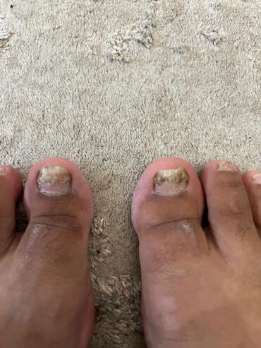 Маникюр, педикюр: Ремонт сломаных ногтей, Снятие, Укрепление ногтей, Услуги подолога, Одноразовые расходные материалы, Консультация, С выездом на дом — 13