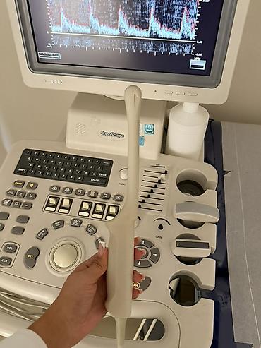 dinakort aparat: SinoSonic SonoScape SI-6000 ultrasəs diaqnostika aparatı — 9