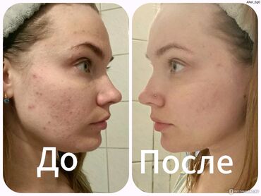 маска игры в кальмара: Ты больше не выбираешь между “от прыщей” и “от морщин” — ты выбираешь