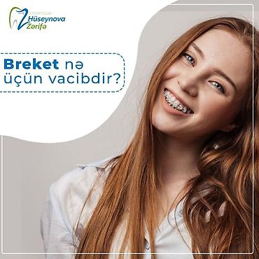 сколько стоят брекеты в баку: İnstaqram dr.zerif). Seçilən pasientlerə sonda kappa hədiyyə — 3