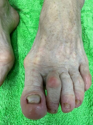 Маникюр, педикюр: Коррекция вросших ногтей, Маникюр, Педикюр, Услуги подолога, Консультация, Одноразовые расходные материалы — 4