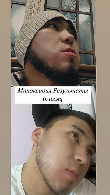 знаки: Сыворотка для роста бороды и волос RIJAL REAXIDIL 15% Minoxidil Что — 3