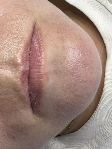 Косметика: Процедура перманентного макияжа губ позволяет придать губам желаемый — 23