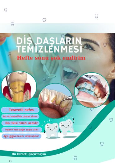 Ev personalı və təmizlik: Diş daşların temizlenmesi hefte sonu şok endirim