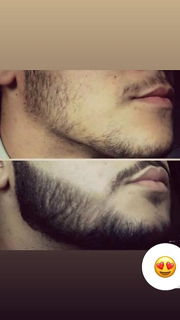 Уход за телом: Рост борода и волосы Миноксидил ультра 15% оригинал✅из Турции🇹🇷 — 7