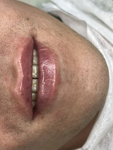 Косметика: Процедура перманентного макияжа губ позволяет придать губам желаемый — 31