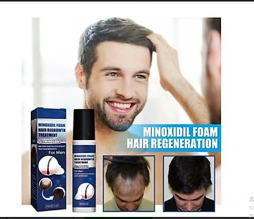 Уход за телом: США Миноксидил ОРИГИНАЛ от облысения ПЕНКА СПРЕЙ КОТОРУЮ НЕ — 7