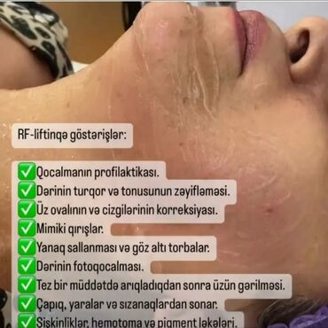 Masaj: Müalicəvi masaj, Uşaqlar üçün, Kişilər üçün, Qadınlar üçün, Klinikada -da lalafo.az — 2 Masaj: Müalicəvi masaj, Uşaqlar üçün, Kişilər üçün, Qadınlar üçün, Klinikada — 2