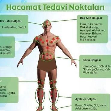 hicama banka: Hicama, zəli, masaj xidməti Hicama, zəli, masaj xidməti, sağlamlığa — 1