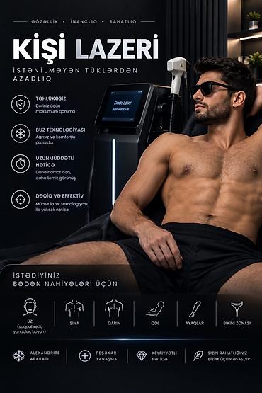texnik: Bakıxanov(razin) kişi salonuna lazeroloq axtarılır. Fikri ciddi olan — 1