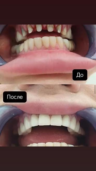 ресницы накладные: Стоматолог. Больше 6 лет опыта. Аренда места — 3