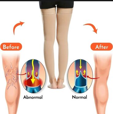 böyük bədən paltarlar: Varikoza qarşı proffesional corab 
tam şəkildəki kimi 
ölçülərlə