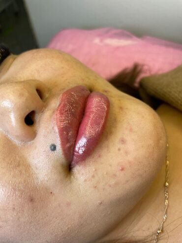 Косметология: Косметология, Биоревитализация, Ботокс, Ботулинотерапия, Требуются модели, Гипоаллергенные материалы, Консультация — 2