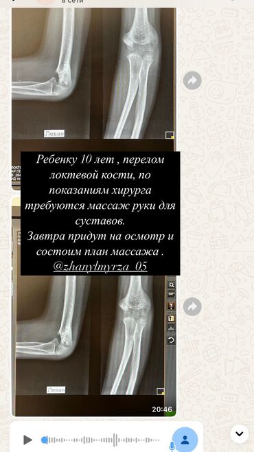 масаж кара балта: Массаж | Балдар үчүн | Кифос, лордоз, Омуртка түркүгүнүн капталына кыйшайышы | Үйүнө баруу менен