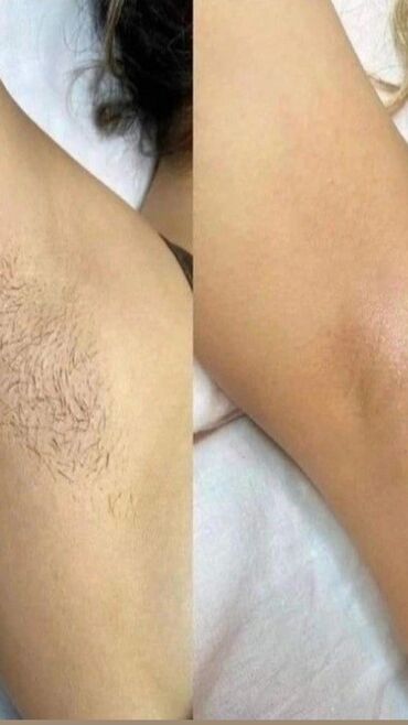 ремонт и реставрация мягкой мебели бишкек олег: Шугаринг, Үйгө баруу кызматы менен