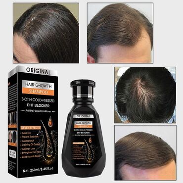 saç ağarmasına qarşı vitamin: Saç şampunu, Saç tökülməsinə qarşı, Yeni, Pulsuz çatdırılma