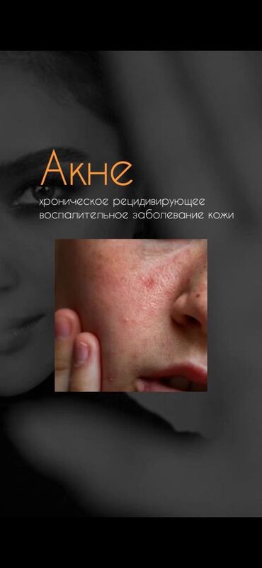 уход за кожей лица после 35: Косметолог | Демодекоз, Лечение угревой болезни, Маски | Сертифицированный косметолог