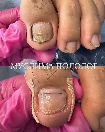 дезинфектор: Подологические услуги Специалист: Муслима — подолог. Направления — 9