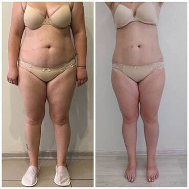 массажист в бишкеке: Массаж | Лимфодренажный массаж | Консультация