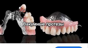 Стоматологи: Съёмные зубные протезы под ваши задачи - Вакуумные протезы: плотная — 2