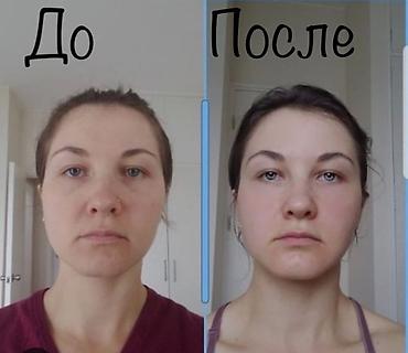 кабинет косметология: Косметология, Маски, Массаж лица, Разглаживание и коррекция морщин, Консультация, Гипоаллергенные материалы — 3
