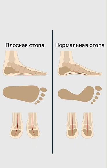 колени: Тренажер от плоскостопия Эргономичный тренажёр для стоп — 3