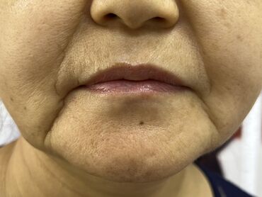 Косметология: Косметология, Ботокс, Биоревитализация, Ботулинотерапия, Консультация, Гипоаллергенные материалы, Сертифицированный косметолог — 24