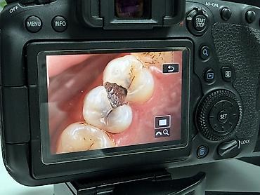 Фотоаппараты: Стоматология Canon 6D MARK 2 CANON MACRO 100mm GODOX MF12 вспышки at lalafo.kg — 6 Фотоаппараты: Стоматология Canon 6D MARK 2 CANON MACRO 100mm GODOX MF12 вспышки — 6