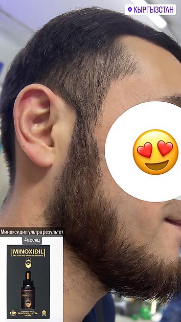 Уход за телом: Миноксидил ультра 15% 100мл 3 месяц хватает Для бороды и волосы — 16