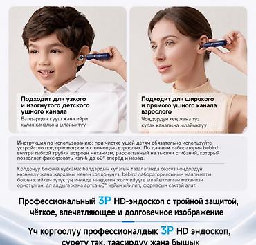 ухо чиска: Умная ушная палочка с камерой Bebird R37R Купить в Бишкеке — HD камера — 10