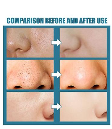 Уход за телом: ❄️ США СЫВОРОТКА ДЛЯ КОЖИ ОТБЕЛИВАНИЕ цена-450сом\флак-розниц — 4