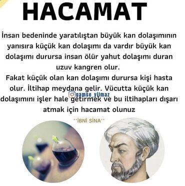 Hicama, zəli: Salam Aleykum.Yalnız Xanımları Hicama edirəm.Naməhrəmlər — 9
