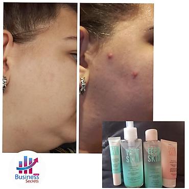 uşaq ucun smart saat: TEEN SKIN dəriyə qulluq seti Məhsul tərkibi: - Gel yuma vasitəsi (üz — 1