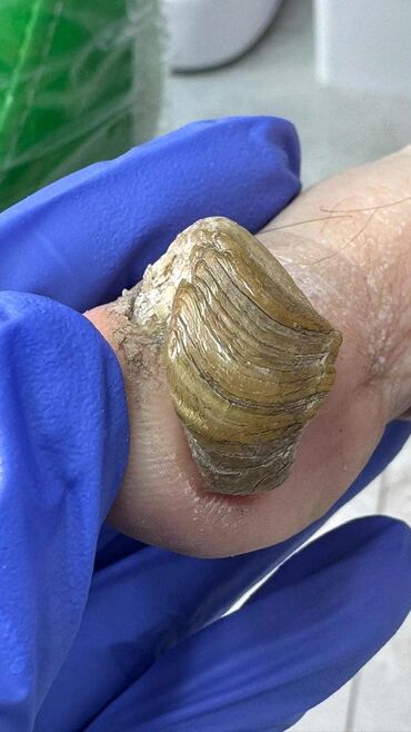 маникюр педикюр с выездом на дом: Коррекция вросших ногтей, Услуги подолога, Одноразовые расходные материалы