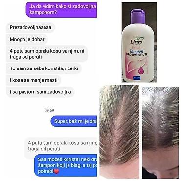 Ortopedski dušeci i jastuci: Limes proizvodi Porudzbine,saradnja postani moj kupac,saradnik — 122