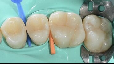 стоматолог терапевт: Стоматолог. Азия Молл