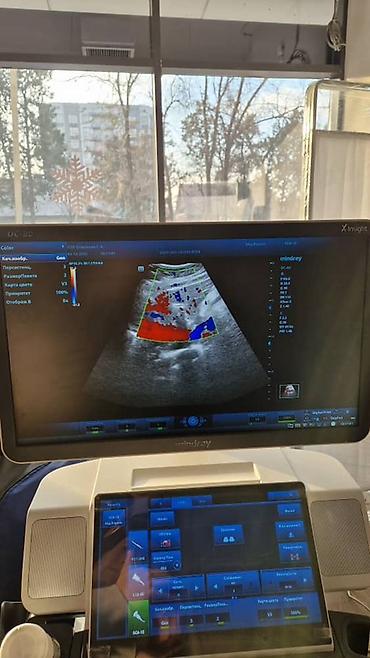 Медицинское оборудование: Продаётся УЗИ аппарат экспертного класса Mindray DC-80 X-INSIGHT — 8