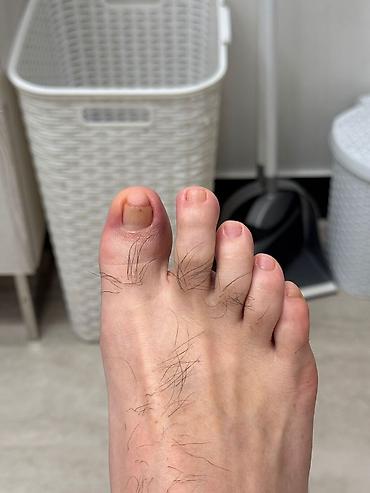 Маникюр, педикюр: Коррекция вросших ногтей, Услуги подолога, С выездом на дом, Консультация, Одноразовые расходные материалы — 10