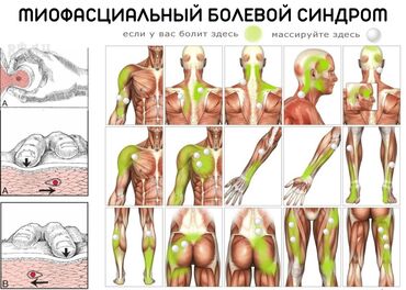 работа в бишкеке швейный цех упаковщик 2020: Миопрессура.
массаж