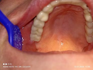 Медицинские услуги: Клиника | Стоматолог | Протезирование — 5