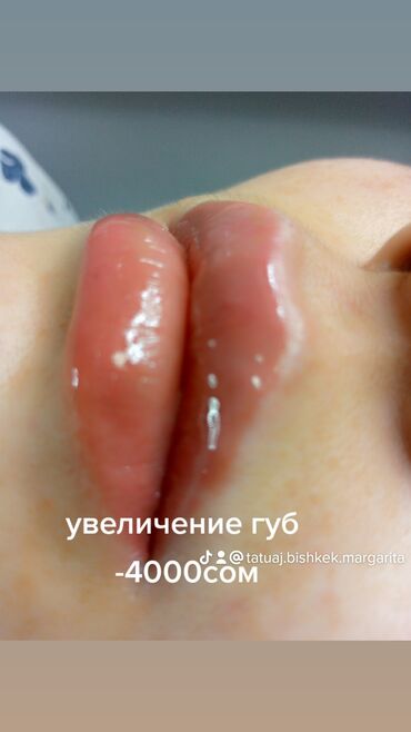 Косметология: Косметология, Биоревитализация, Ботулинотерапия, Контурное моделирование, Гипоаллергенные материалы, Консультация, Сертифицированный косметолог — 7