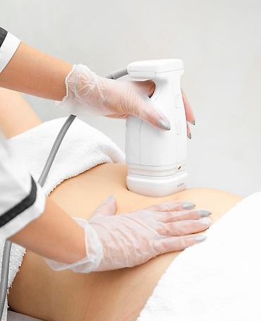 Gözəllik və estetika avadanlığı: Liposoniks Bədənin formalaşması üçün yüksək intensivliyə yönəldilmiş — 3
