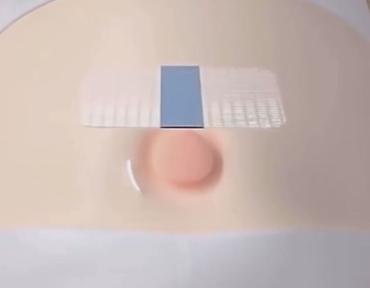 Bintlər, sarğılar: Uşaq üçün göbək yırtığına qarşı yapışqan plastır dəsti Məhsul: Baby — 9