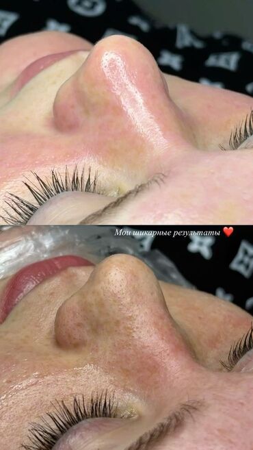 Косметология: Косметология, Пилинг, Ботулинотерапия, Плазмолифтинг, Консультация, Требуются модели, Сертифицированный косметолог — 4