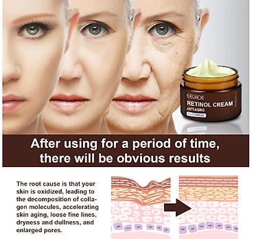 третиноин крем: ❄️ США с Аmazon Walmart и Fruugо Антивозрастной Омолаживающий Retinol — 10