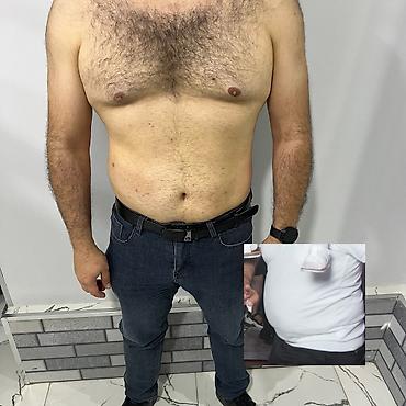 mega express: Arıqlama masajı, Kişilər üçün, Klinikada — 8